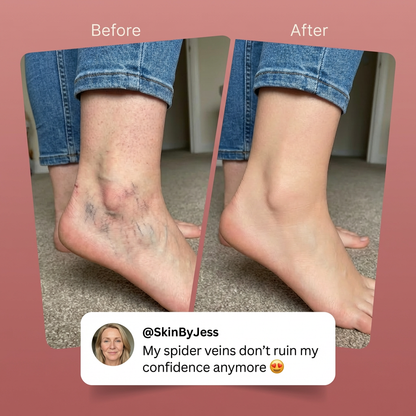 Blumea™ Body Perfecteur & Spider Vein Concealer